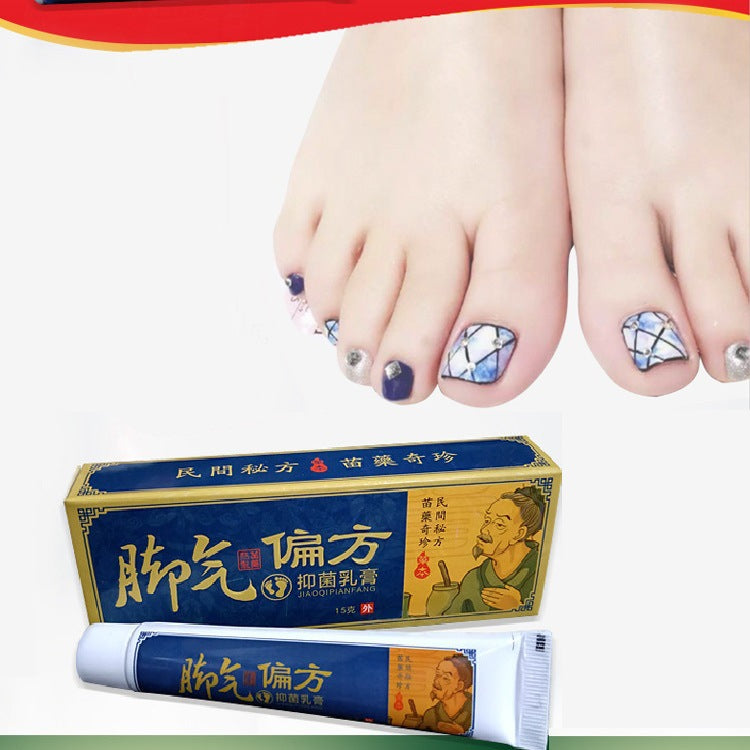 Foot Psoriasis and Eczema Herbal Cream