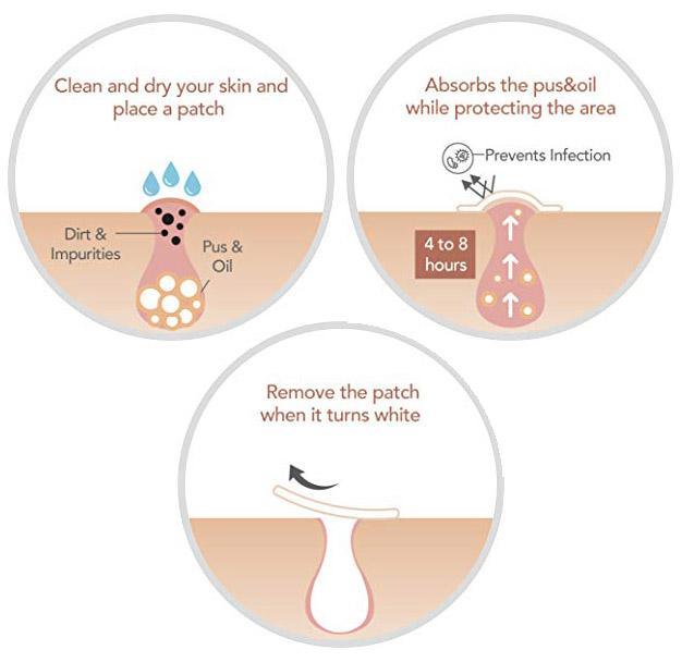 Skin Tag & Acne Patch